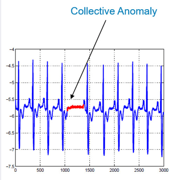 La détection des anomalies